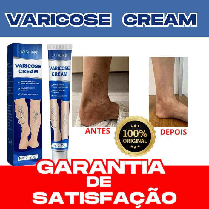 Pomada para varizes Varicose Cream