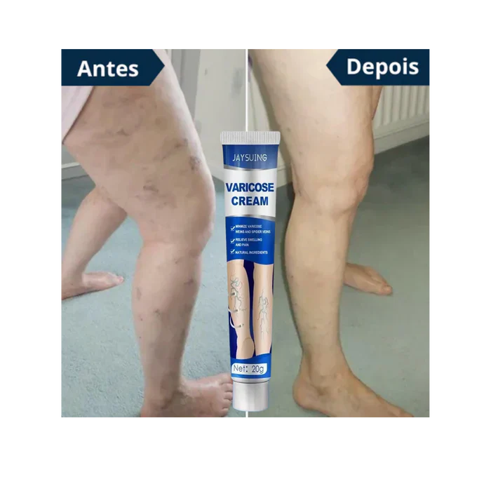 Pomada para varizes Varicose Cream