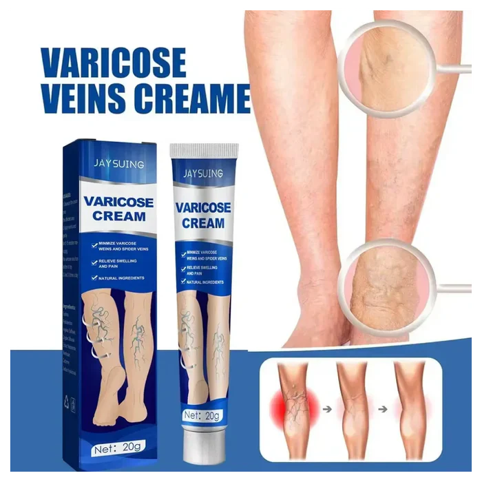 Pomada para varizes Varicose Cream
