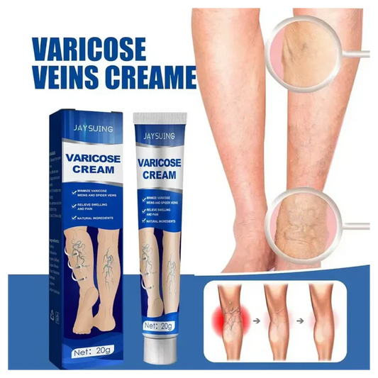 Pomada para varizes Varicose Cream